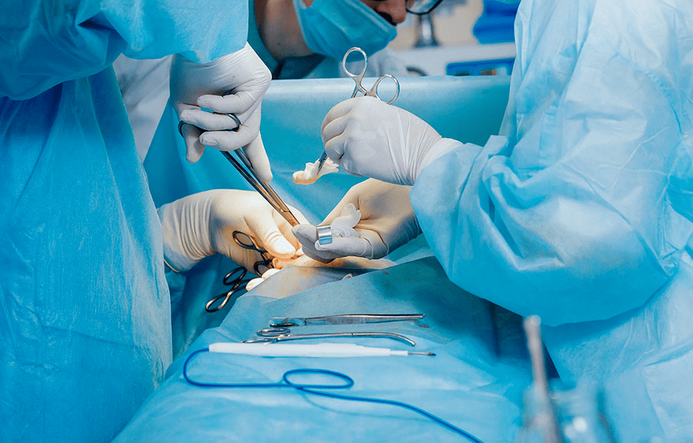 método cirúrgico de aumento do pênis